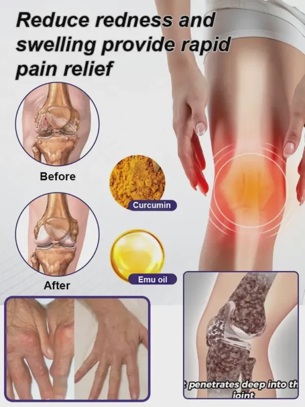 LOVILDS™ Turmeric & Emu Oil Arthritis Soothing Pain Relief Massage Gel 👨‍⚕️Australian Osteopathic Association （AOA）Approved