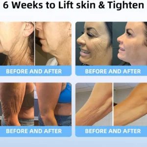 Last day to get 70% OFF: Lovilds™ Bee Toxin & 30-Herb Detox Foot Soak Beads for Body Sculpting- Recommended by the America Lymphatic Academy (ALA) 🧀