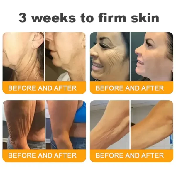 LOVILDS™ 𝘽𝙀𝙀 𝙑𝙀𝙉𝙊𝙈 𝑺𝒌𝒊𝒏 𝑹𝒆𝒔𝒕𝒐𝒓𝒂𝒕𝒊𝒐𝒏 𝑪𝒓𝒆𝒂𝒎 –🌸 Anti-aging,Hydrating, Skin Repair, Even Tone, Acne and Dark Spot Treatment, Wart and Mole Removal, Psoriasis Relief