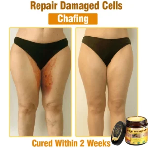 LOVILDS™ Bee Venom All-in-One Cream US Dermatologist Approved