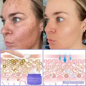🎁LOVILDS® Bee Venom Multi-Action Face Cream, certified by American dermatologists (👩⚕️FDA recommended)💥