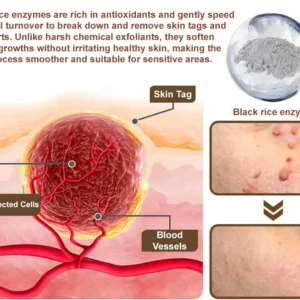 LOVILDS® Black Rice Skin Repair Essence Cream 👨⚕️ MHRA Certified (Removes warts and skin growths, improves keratin buildup and seborrheic dermatitis, follicular keratosis, skin cancer, and age spots)