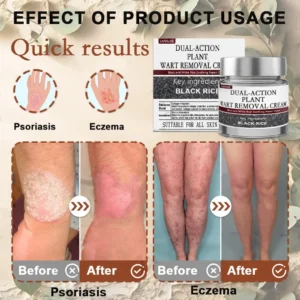 LOVILDS® Black Rice Skin Repair Essence Cream 👨⚕️ MHRA Certified (Removes warts and skin growths, improves keratin buildup and seborrheic dermatitis, follicular keratosis, skin cancer, and age spots)