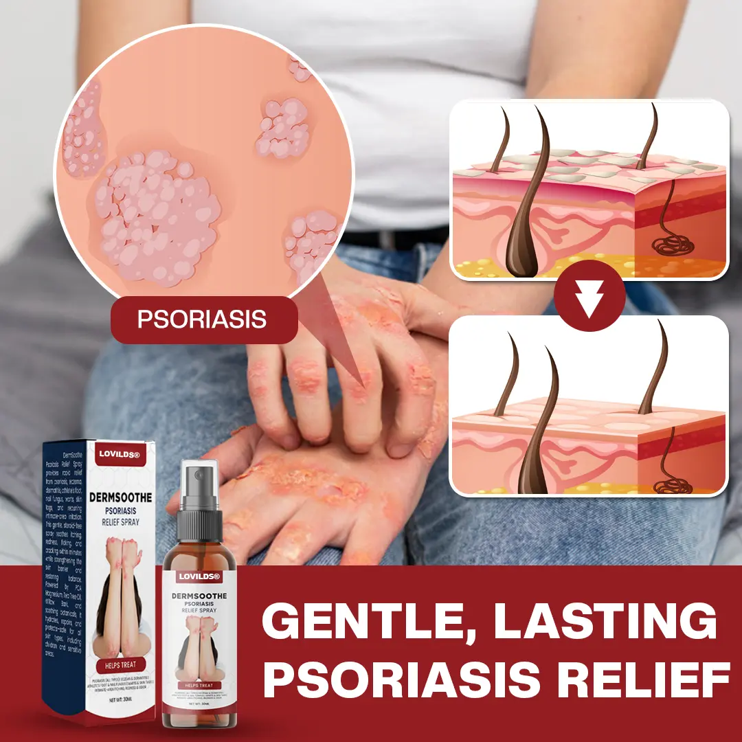 LOVILDS® DermSoothe Psoriasis Relief Spray