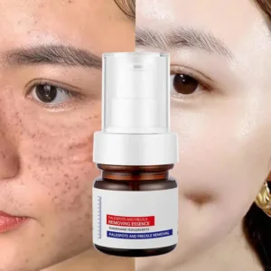 LOVILDS™  WHITENING ANDFRECKLE REMOVING ESSENCE