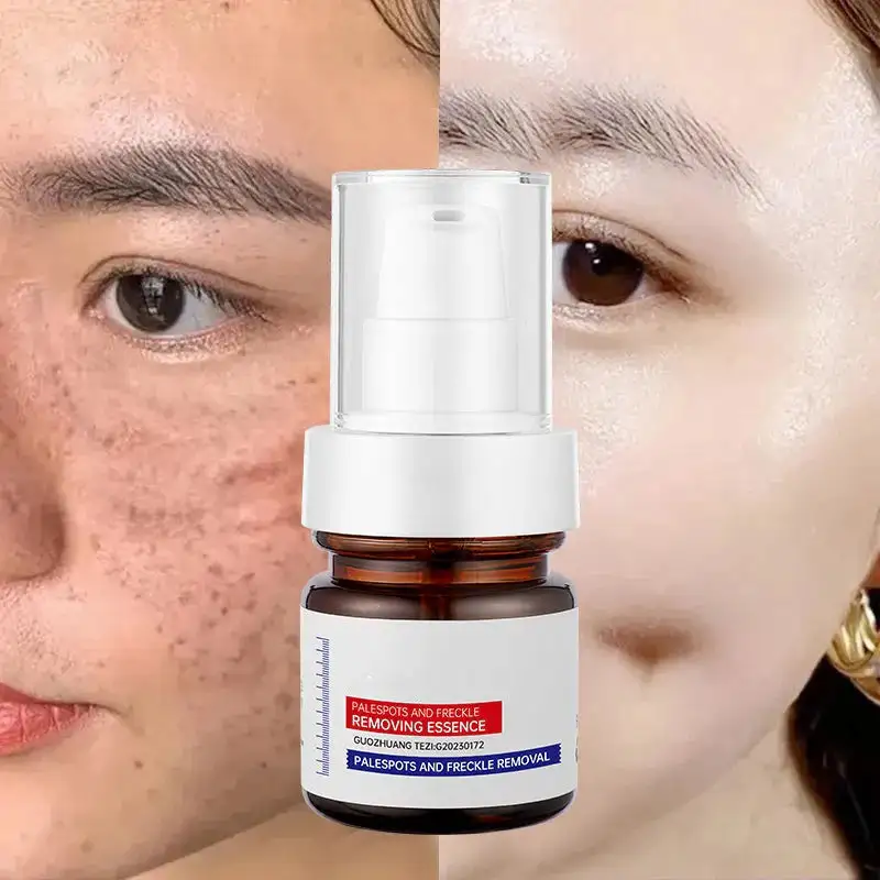 LOVILDS™  WHITENING ANDFRECKLE REMOVING ESSENCE