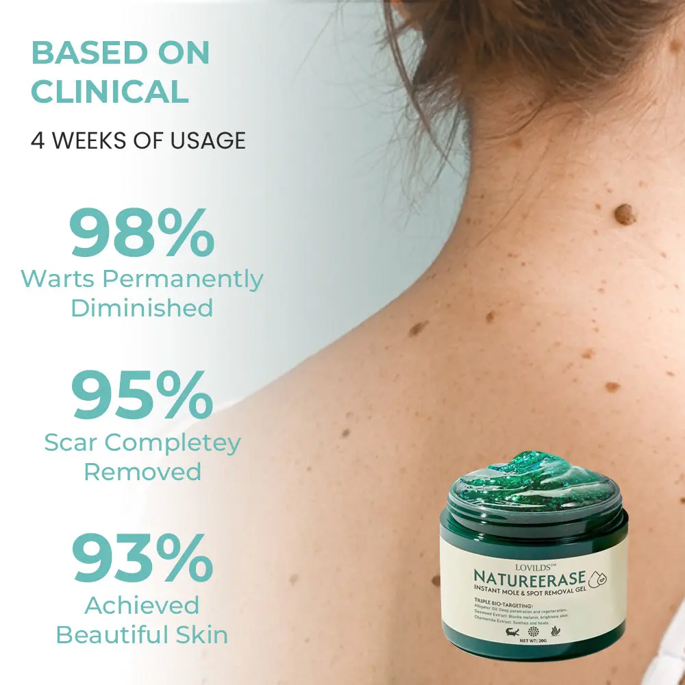 🔥(Official retail store) LOVILDS™ NatureErase Instant Mole & Spot Removal Gel