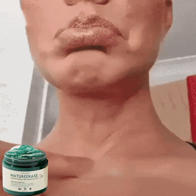 🔥(Official retail store) LOVILDS™ NatureErase Instant Mole & Spot Removal Gel