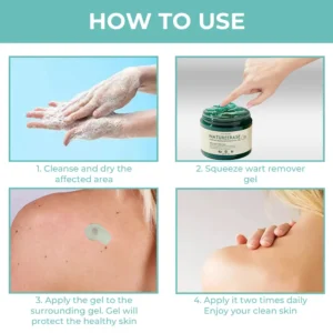 🔥(Official retail store) LOVILDS™ NatureErase Instant Mole & Spot Removal Gel