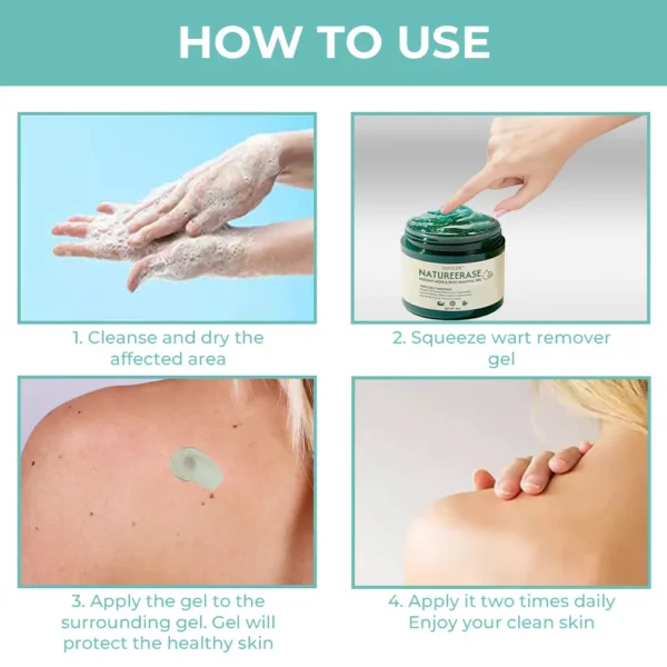 🔥（Official retail store） LOVILDS™ NatureErase Instant Mole & Spot Removal Gel