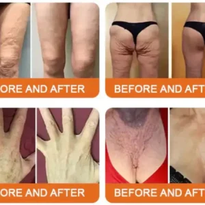 LOVILDS® Bee Toxin Lift Cream