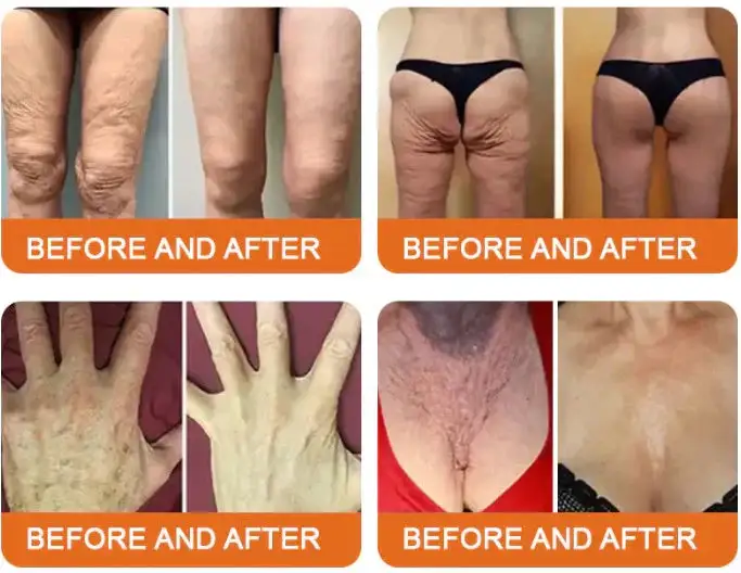 LOVILDS® Bee Toxin Lift Cream