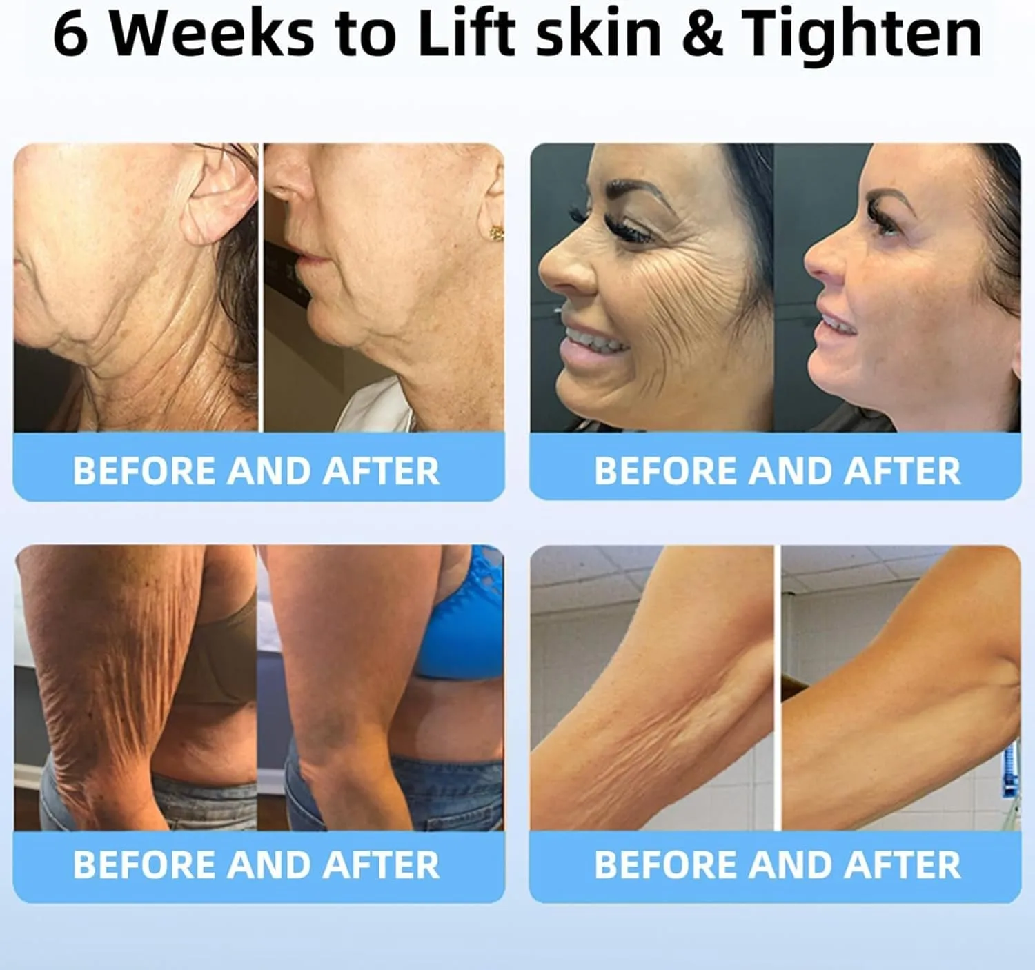 LOVILDS® Bee Toxin Lift Cream