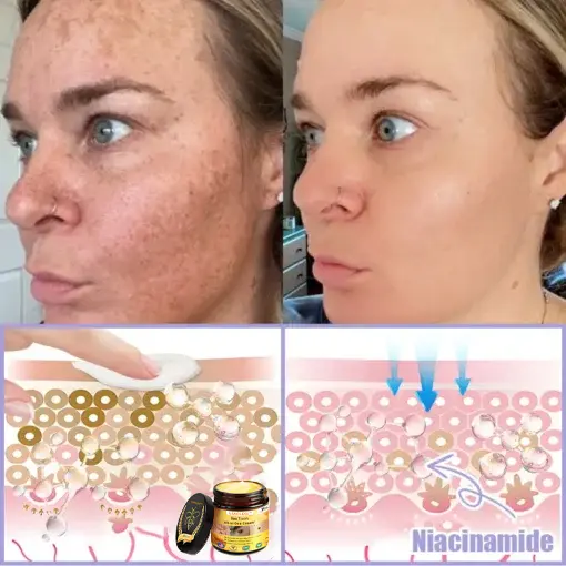 LOVILDS® Bee Toxin Lift Cream
