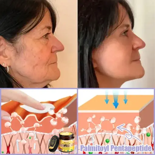 LOVILDS® Bee Toxin Lift Cream