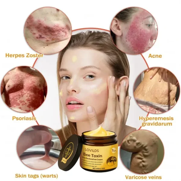 LOVILDS® Bee Toxin  Skin Restoring Cream