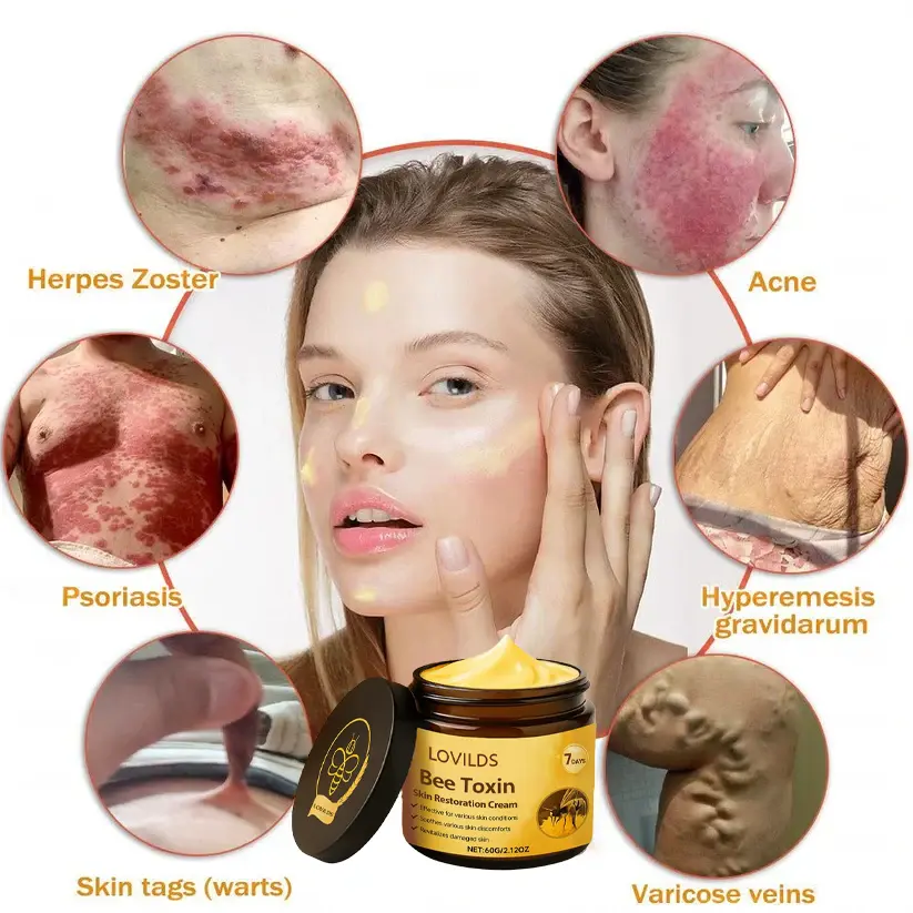 LOVILDS® Bee Toxin  Skin Restoring Cream