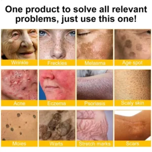 LOVILDS® Bee Toxin  Skin Restoring Cream