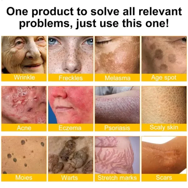 LOVILDS® Bee Toxin  Skin Restoring Cream
