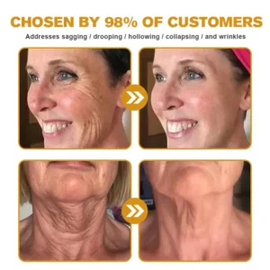 LOVILDS® Bee Toxin  Skin Restoring Cream