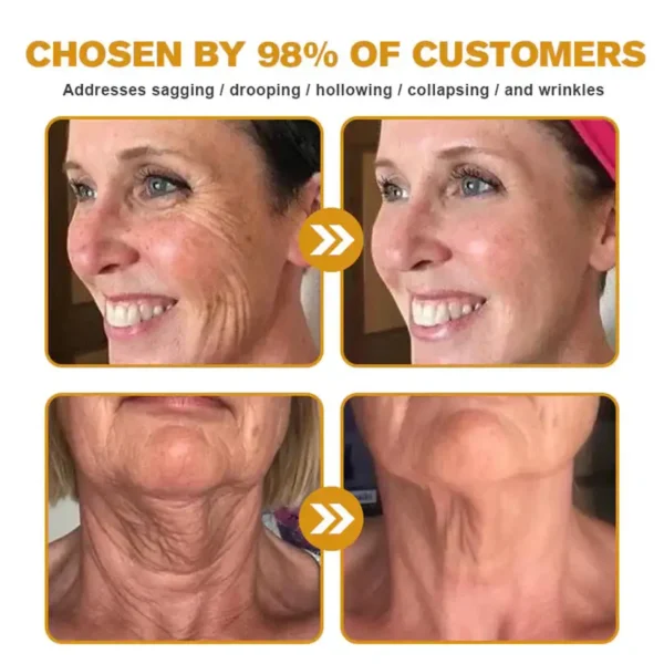 LOVILDS® Bee Toxin  Skin Restoring Cream