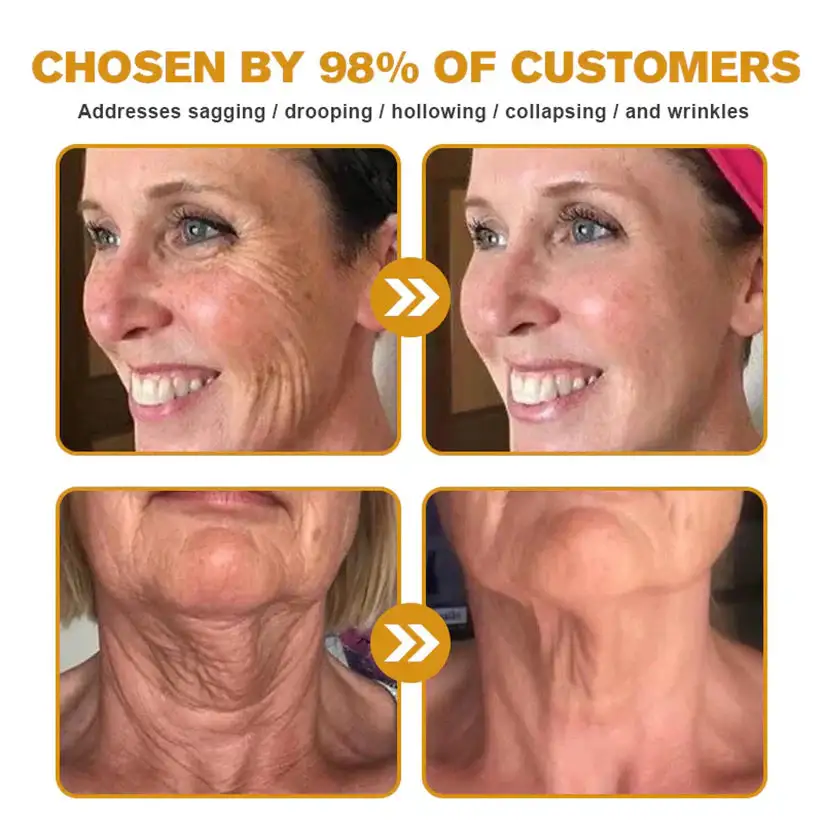 LOVILDS® Bee Toxin  Skin Restoring Cream