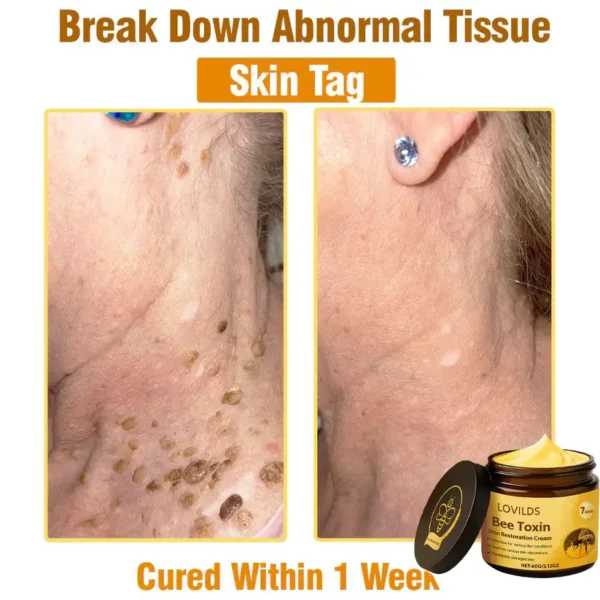 LOVILDS® Bee Toxin  Skin Restoring Cream