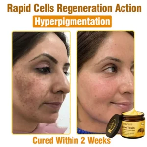 LOVILDS® Bee Toxin  Skin Restoring Cream