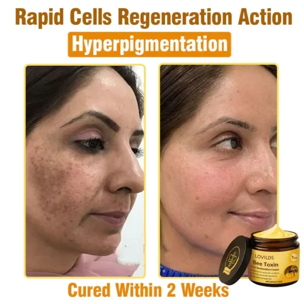 LOVILDS® Bee Toxin  Skin Restoring Cream