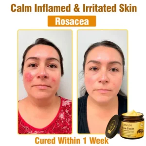 LOVILDS® Bee Toxin  Skin Restoring Cream