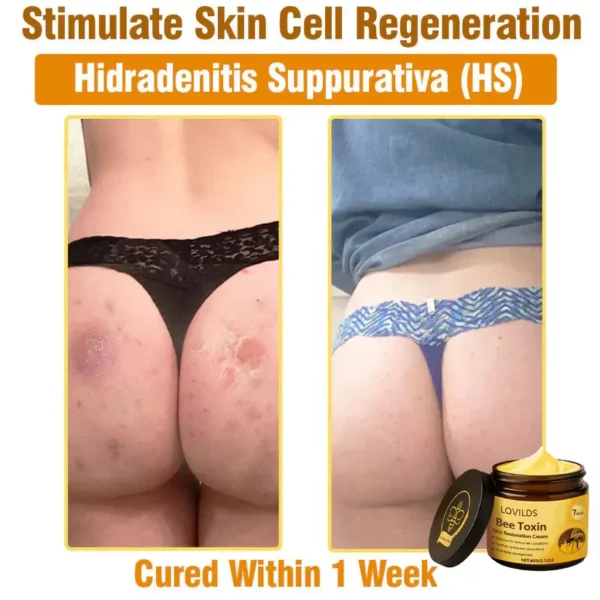 LOVILDS® Bee Toxin  Skin Restoring Cream