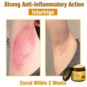 LOVILDS® Bee Toxin  Skin Restoring Cream
