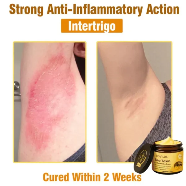 LOVILDS® Bee Toxin  Skin Restoring Cream