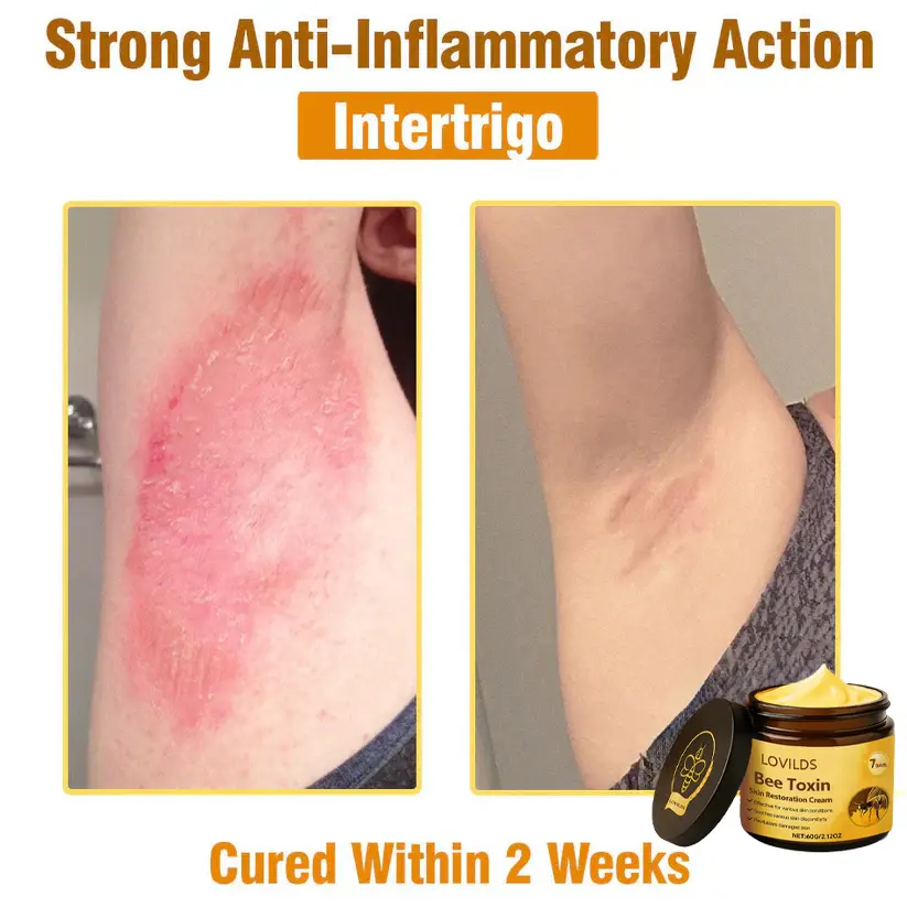 LOVILDS® Bee Toxin  Skin Restoring Cream