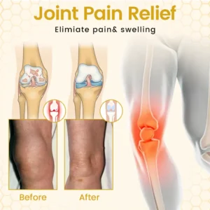 LOVILDS® VenomFlex Bee Therapy Cream