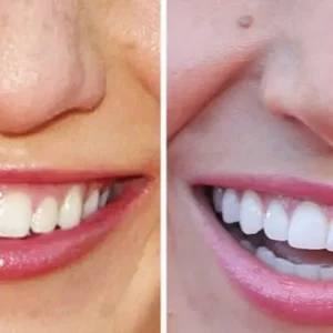 Lovilds™ Advanced Dental Care Toothpaste — Fights Gum Disease, Cavities & Tooth Sensitivity” ✅