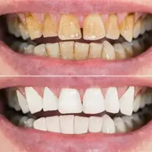 Lovilds™ Advanced Dental Care Toothpaste — Fights Gum Disease, Cavities & Tooth Sensitivity” ✅