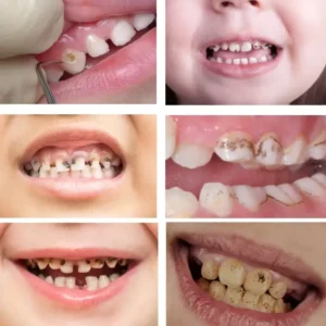 Lovilds™ Advanced Dental Care Toothpaste — Fights Gum Disease, Cavities & Tooth Sensitivity” ✅