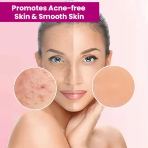 🎁🎁BUY 1 GET 1 FREE🎁LOVILDS™ Tags & Moles Remover