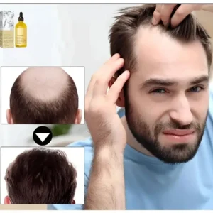 🎄🎁(Christmas Sale – Huge Discounts!)LOVILDS™ Rosemary Hair Growth Essence 100% Natural Hair Growth🌱