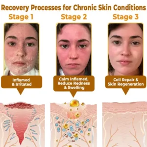 ✨FDA Approved:LOVILDS™  Bee Poison Skin Restoration Cream — 🔥Limited Time 70% OFF🔥