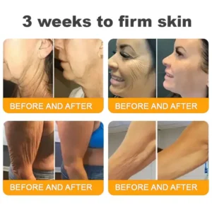 ✨FDA Approved:LOVILDS™ Bee Venom Skin Restoration Cream — 🔥Limited Time 80% OFF🔥