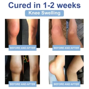 FDA Certified: LOVILDS® Black Rice Pain Healing Bone Cream ( Treatment for Arthritis, Rheumatic Diseases, Osteoarthritis, Neuropathyy Muscle Spasms and Cramps, Sports Injuries)