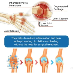 LOVILDS® 𝐁𝐏𝐂-𝟏𝟓𝟕 𝐉𝐨𝐢𝐧𝐭 𝐇𝐞𝐚𝐥𝐢𝐧𝐠 𝐂𝐫𝐞𝐚𝐦 𝐓𝐫𝐞𝐚𝐭𝐬 𝐀𝐫𝐭𝐡𝐫𝐢𝐭𝐢𝐬, 𝐍𝐞𝐮𝐫𝐨𝐩𝐚𝐭𝐡𝐲, 𝐑𝐡𝐞𝐮𝐦𝐚𝐭𝐢𝐬𝐦, 𝐒𝐩𝐨𝐫𝐭𝐬 𝐈𝐧𝐣𝐮𝐫𝐢𝐞𝐬 & 𝐌𝐨𝐫𝐞