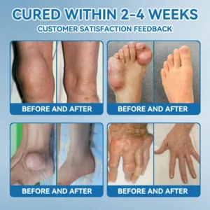 LOVILDS® 𝐁𝐏𝐂-𝟏𝟓𝟕 𝐉𝐨𝐢𝐧𝐭 𝐇𝐞𝐚𝐥𝐢𝐧𝐠 𝐂𝐫𝐞𝐚𝐦 𝐓𝐫𝐞𝐚𝐭𝐬 𝐀𝐫𝐭𝐡𝐫𝐢𝐭𝐢𝐬, 𝐍𝐞𝐮𝐫𝐨𝐩𝐚𝐭𝐡𝐲, 𝐑𝐡𝐞𝐮𝐦𝐚𝐭𝐢𝐬𝐦, 𝐒𝐩𝐨𝐫𝐭𝐬 𝐈𝐧𝐣𝐮𝐫𝐢𝐞𝐬 & 𝐌𝐨𝐫𝐞