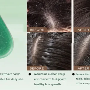 LOVILDS™ 2-in-1 Herbal Shampoo Bar