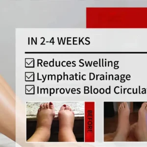 LOVILDS® Advanced CVI Edema Restorative Cream