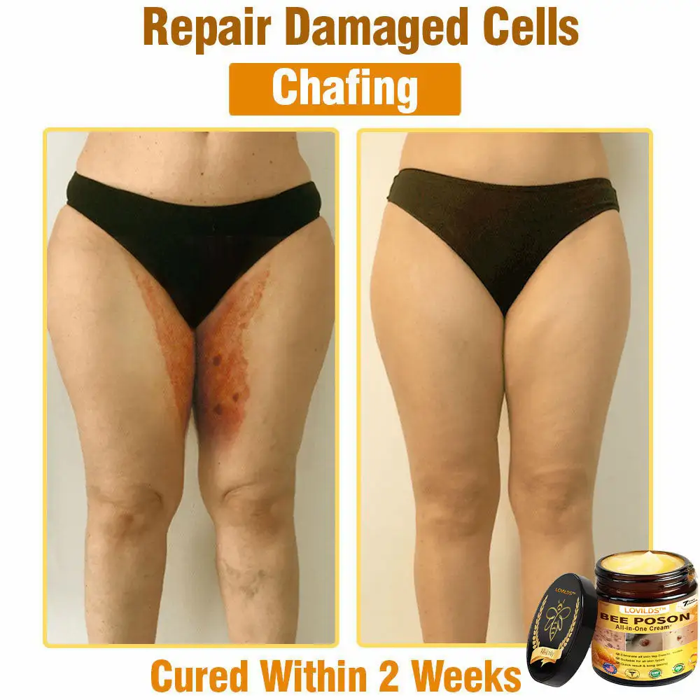 LOVILDS™ BEE POSON All-in-One Cream US Dermatologist Approved