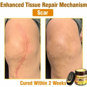 LOVILDS™ BEE POSON All-in-One Cream US Dermatologist Approved