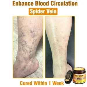 LOVILDS™ Bee Poison All-in-One Cream US Dermatologist Approved